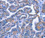 Anti-Human IGSF10 Antibody - ABMIUM