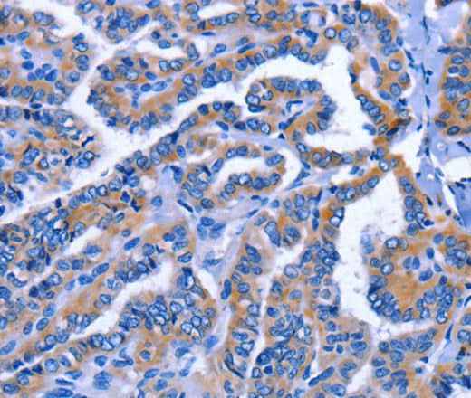 Anti-Human IGSF10 Antibody
