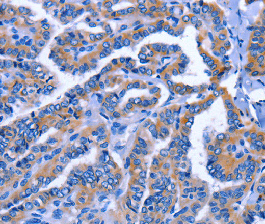 Anti-Human IGSF10 Antibody - ABMIUM