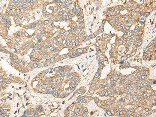 Anti-Human/Mouse CPNE3 Antibody