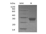 Recombinant Human TNFSF4/OX40L Protein (His Tag) - ABMIUM