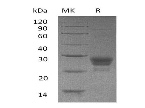 Recombinant Human TNFSF4/OX40L Protein (His Tag) - ABMIUM