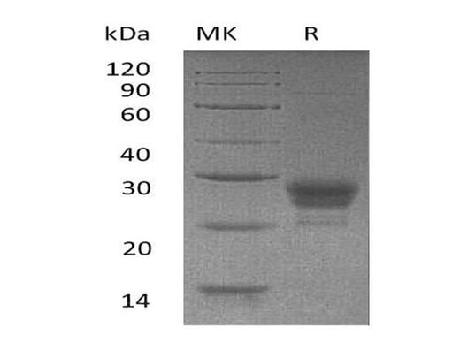 Recombinant Human TNFSF4/OX40L Protein (His Tag) - ABMIUM