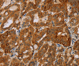 Anti-Human/Mouse/Rat MTUS1 Antibody - ABMIUM