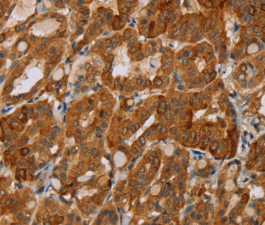 Anti-Human/Mouse/Rat MTUS1 Antibody - ABMIUM