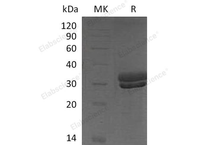 Recombinant Mouse Kallikrein 7/KLK7 Protein (His Tag) - ABMIUM