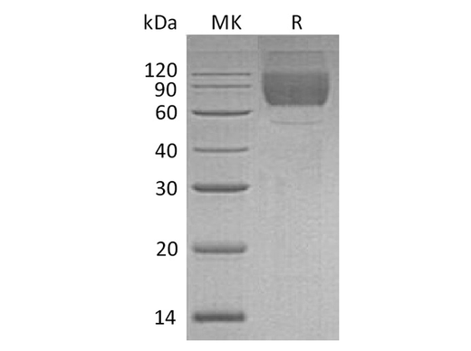 Recombinant Human LIMP-2/LIMPII Protein (His Tag) - ABMIUM