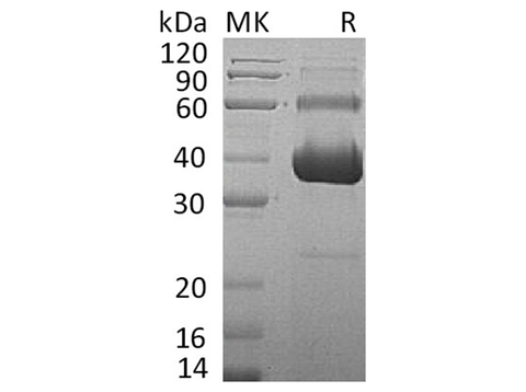 Recombinant Human Activin RIIA/ACVR2A Protein (Fc & His Tag) - ABMIUM