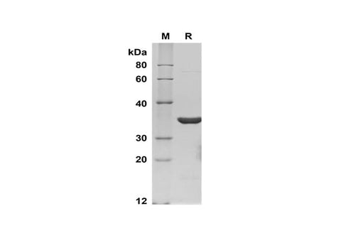 SDS-PAGE analysis of Human Annexin V/ANXA5/Annexin A5 proteins, 2 μg/lane of Recombinant Human Annexin V/ANXA5/Annexin A5 proteins was resolved with SDS-PAGE under reducing conditions, showing bands at 36 kDa.