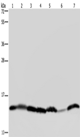 Anti-Human/Mouse HIST1H2AH Antibody - ABMIUM