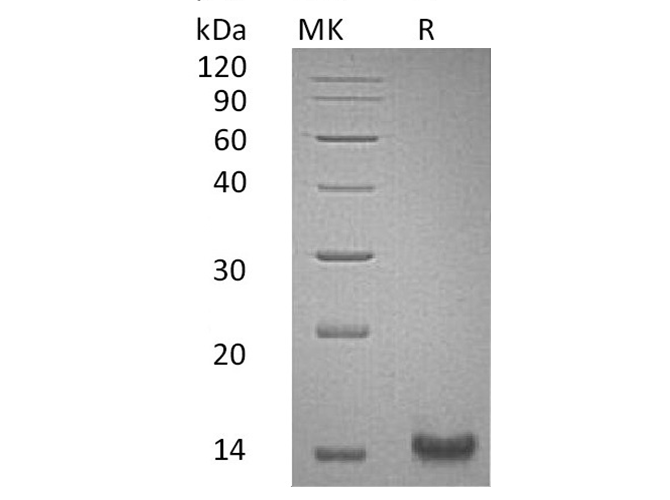 Recombinant Human Trefoil Factor 1/TFF1 Protein (His Tag) - ABMIUM