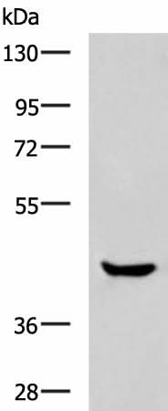 Western blot analysis of Human muscle tissue lysate using HOXA2 Polyclonal Antibody at dilution of 1:800
