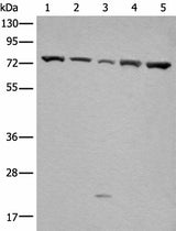 Western blot analysis of Hela and A431 cell Mouse brain tissue HT-29 and Jurkat cell lysates using GARS Polyclonal Antibody at dilution of 1:540