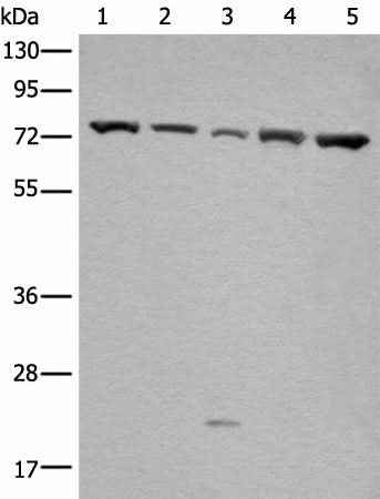 Anti-Human/Mouse/Rat GARS Antibody