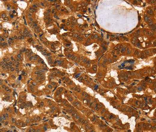 Anti-Human/Mouse IKZF3 Antibody