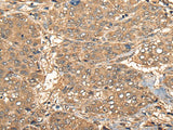 Anti-Human CCL27 Antibody - ABMIUM