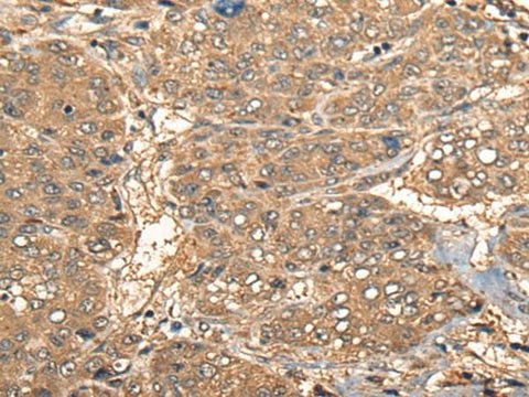 Anti-Human CCL27 Antibody - ABMIUM