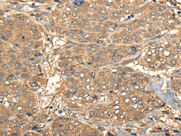 Anti-Human CCL27 Antibody - ABMIUM