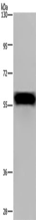 Anti-Human/Mouse/Rat FGB Antibody - ABMIUM