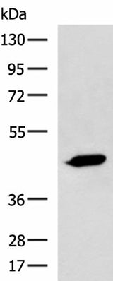 Western blot analysis of A431 cell lysate using ASB10 Polyclonal Antibody at dilution of 1:800