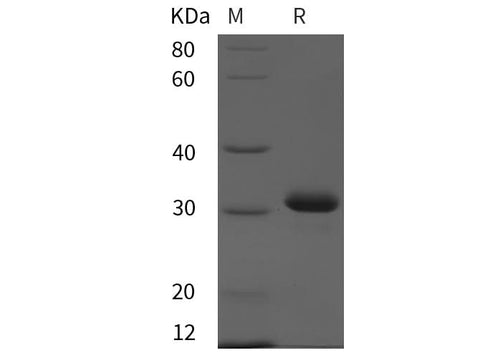 SDS-PAGE analysis of Rat CD80/B7-1 proteins, 2 μg/lane of Recombinant Rat CD80/B7-1 proteins was resolved with SDS-PAGE under reducing conditions, showing bands at 32 kDa.