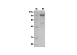 SDS-PAGE analysis of Human MMP-9 proteins, 2 μg/lane of Recombinant Human MMP-9 proteins was resolved with SDS-PAGE under reducing conditions, showing bands at 85 kDa.