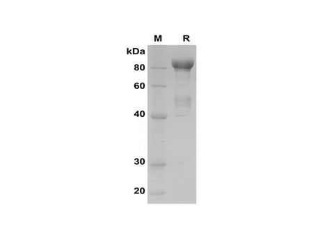 SDS-PAGE analysis of Human MMP-9 proteins, 2 μg/lane of Recombinant Human MMP-9 proteins was resolved with SDS-PAGE under reducing conditions, showing bands at 85 kDa.
