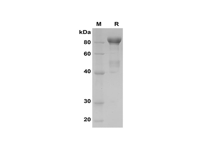 SDS-PAGE analysis of Human MMP-9 proteins, 2 μg/lane of Recombinant Human MMP-9 proteins was resolved with SDS-PAGE under reducing conditions, showing bands at 85 kDa.