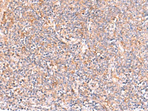 Immunohistochemistry of paraffin-embedded Human tonsil tissue using NADK Polyclonal Antibody at dilution of 1:95(×200)
