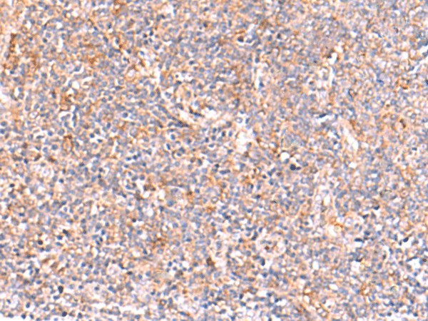 Immunohistochemistry of paraffin-embedded Human tonsil tissue using NADK Polyclonal Antibody at dilution of 1:95(×200)