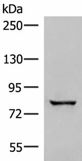 Western blot analysis of Human bladder transitional cell carcinoma grade 2-3 tissue lysate using TTC12 Polyclonal Antibody at dilution of 1:300