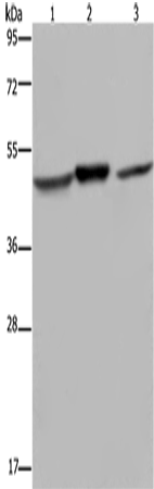 Anti-Human/Mouse/Rat NDUFS2 Antibody - ABMIUM