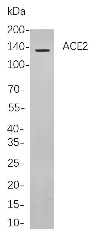 Anti-Human ACE2 Antibody [B880] - ABMIUM