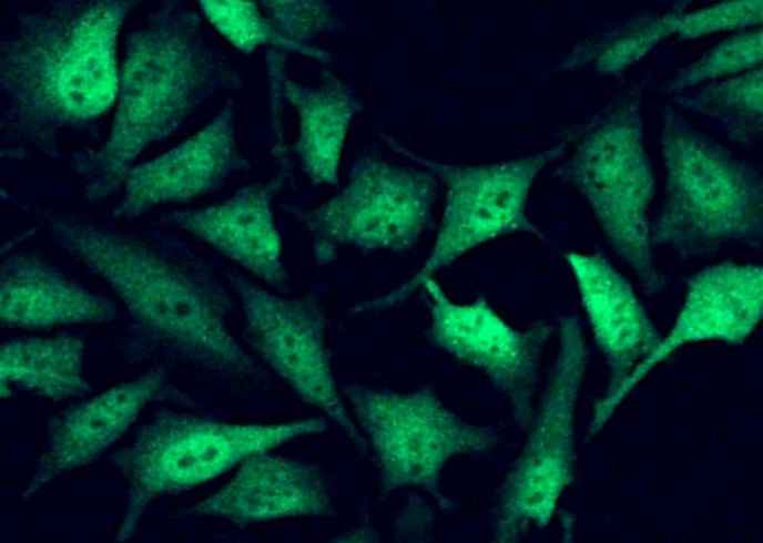 Anti-Human FHIT Antibody [B194] - ABMIUM