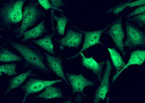 Anti-Human FHIT Antibody [B194] - ABMIUM
