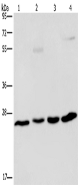 Anti-Human/Mouse ETHE1 Antibody - ABMIUM