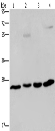 Anti-Human/Mouse ETHE1 Antibody - ABMIUM