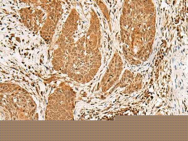 Anti-Human/Mouse/Rat PPOX Antibody