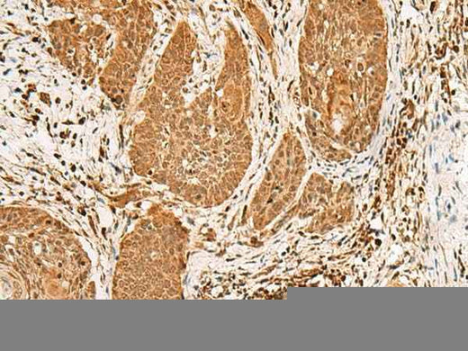 Anti-Human/Mouse/Rat PPOX Antibody