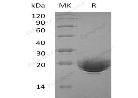 Recombinant Human MOG Protein (Human Cells, His Tag) - ABMIUM