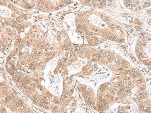 Anti-Human/Mouse ETV3 Antibody - ABMIUM