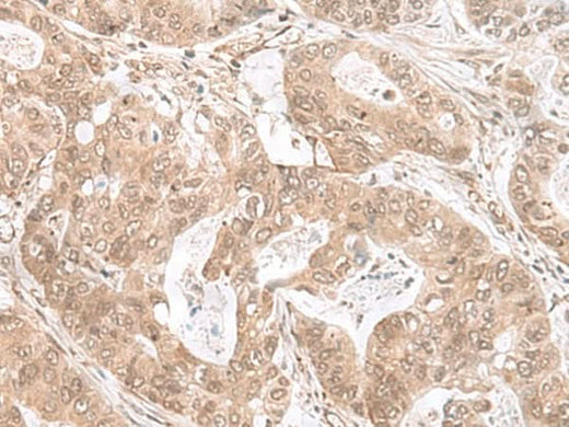 Anti-Human/Mouse ETV3 Antibody - ABMIUM