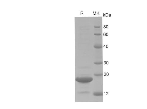 SDS-PAGE analysis of Human MAP1LC3B proteins, 2 μg/lane of Recombinant Human MAP1LC3B proteins was resolved with SDS-PAGE under reducing conditions, showing bands at 18 kDa.