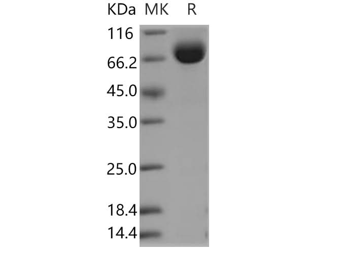 Recombinant Human LRG1 Protein (Fc Tag) - ABMIUM
