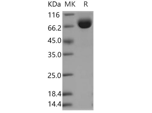 Recombinant Human LRG1 Protein (Fc Tag) - ABMIUM