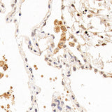 Immunohistochemistry analysis of paraffin-embedded human lung using CXCR7 Polyclonal Antibody at dilution of 1:100.