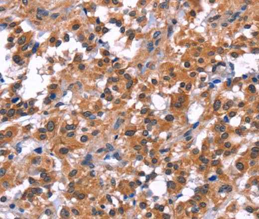 Anti-Human/Mouse/Rat PIP5K1B Antibody