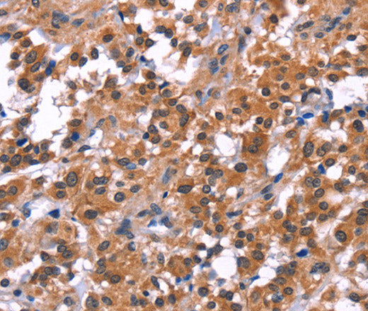 Anti-Human/Mouse/Rat PIP5K1B Antibody - ABMIUM