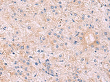 Immunohistochemistry of paraffin-embedded Human tonsil tissue using KANSL1L Polyclonal Antibody at dilution of 1:40(×200)