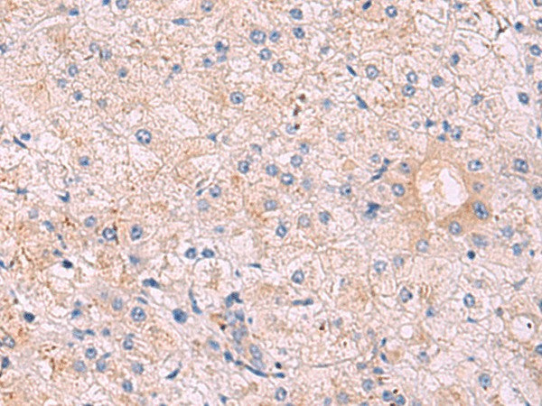 Immunohistochemistry of paraffin-embedded Human tonsil tissue using KANSL1L Polyclonal Antibody at dilution of 1:40(×200)